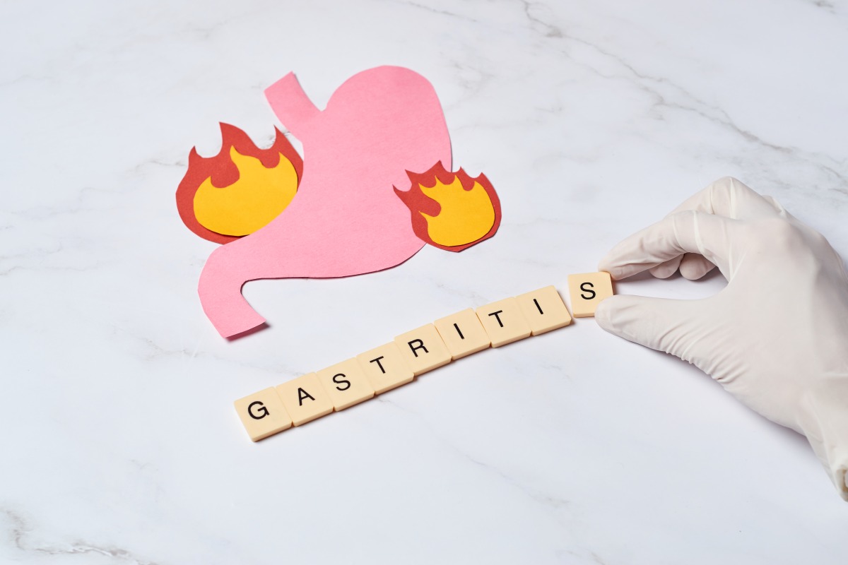 Анатомичен модел на стомаха