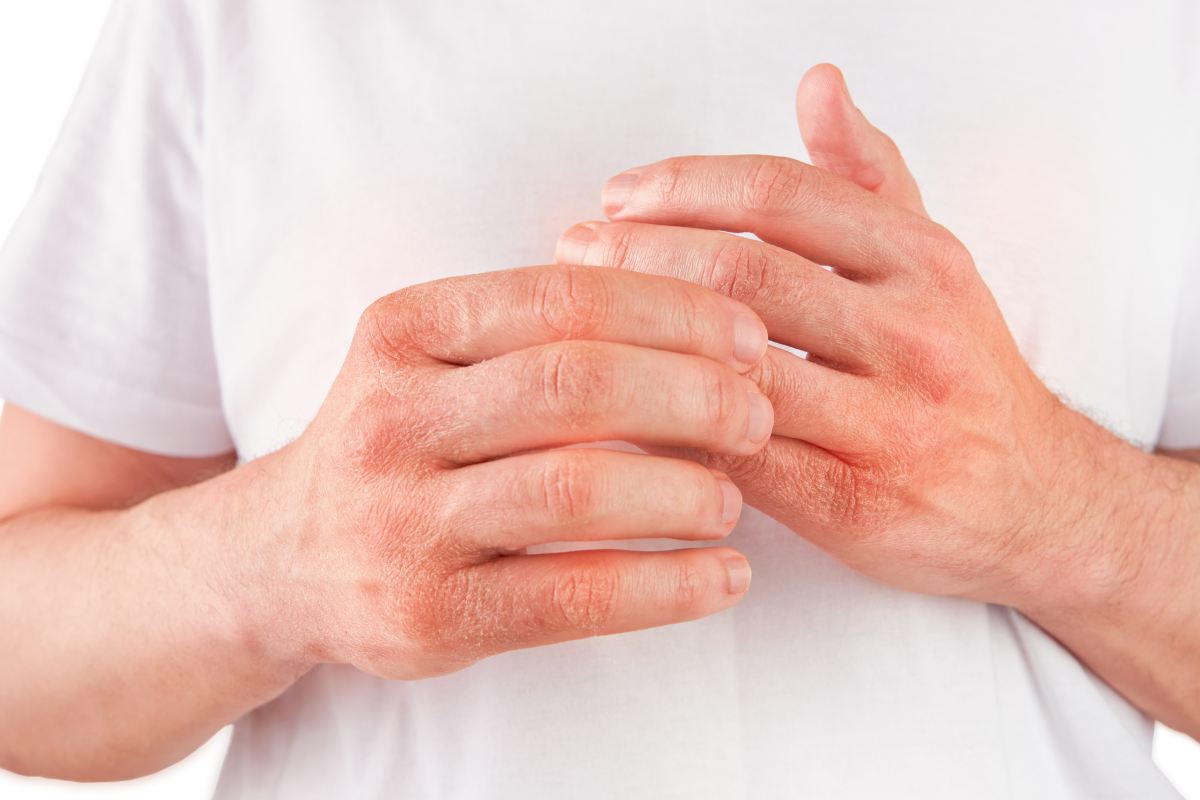 Дамски ръце намазани с крем